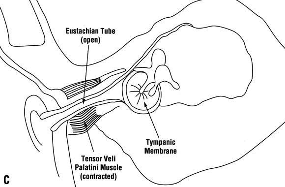580x380 Otitis Media And Eustachian Tube Dysfunction Connection