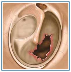 245x246 The Daily Apple Apple