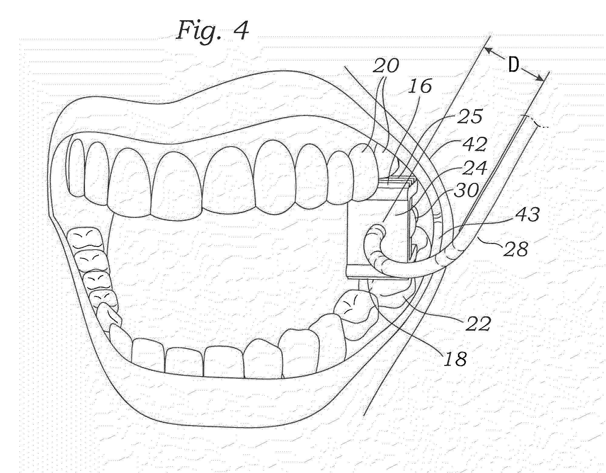 1998x1559 Patent Drawing Patent Drawing