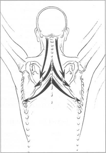 434x623 Elongation When Lifting The Arm
