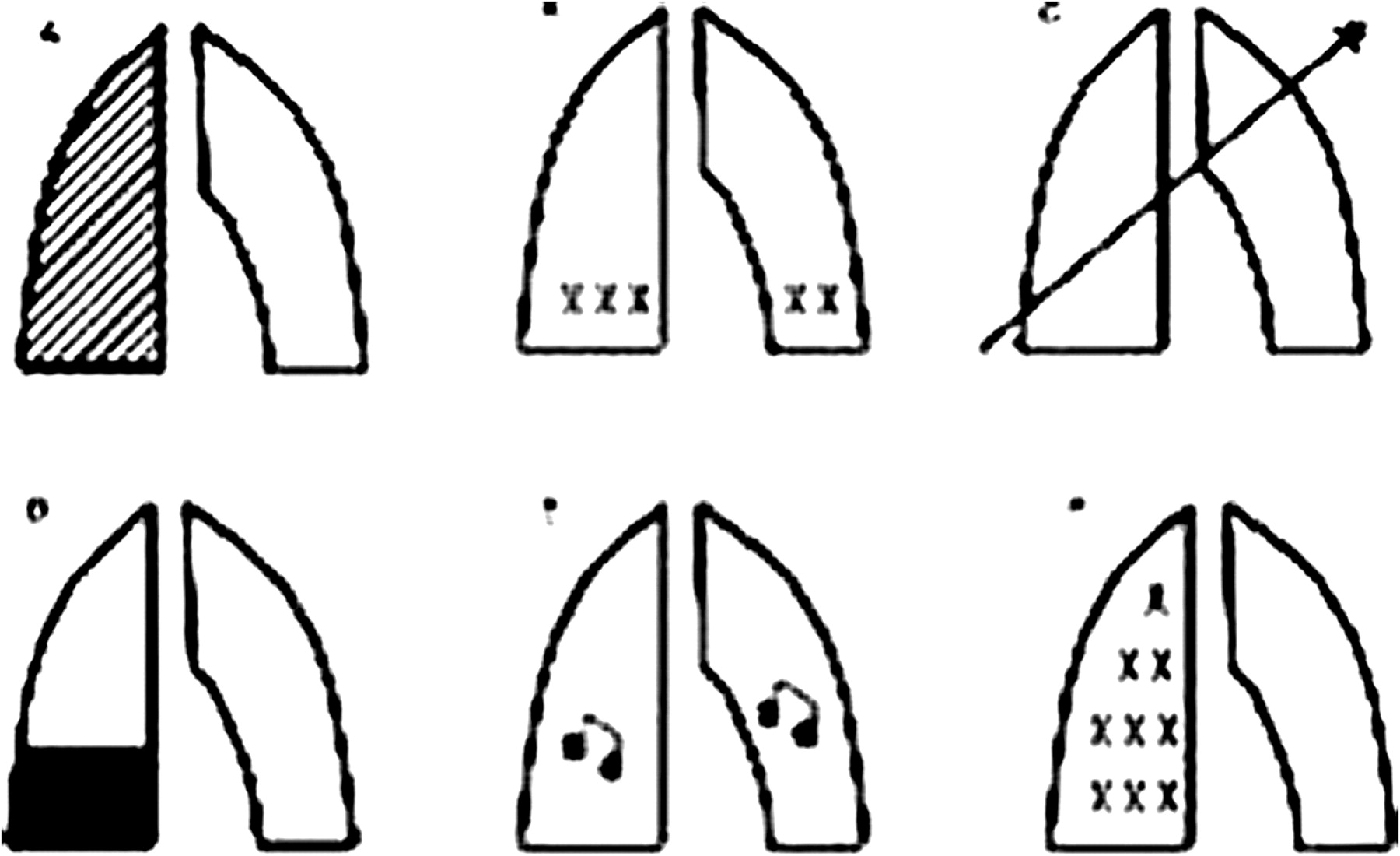1800x1100 P85 Pictorial Representation Of Respiratory Examination