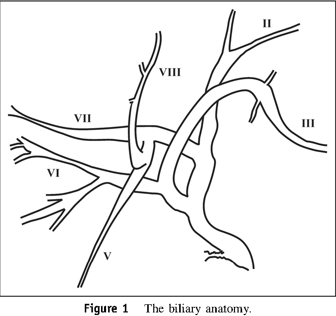 662x622 Figure 1 From Surgical Implications Of A Left Sided Gallbladder
