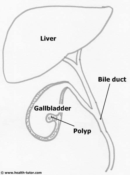 Gallbladder Coloring Page Pages Sketch Coloring Page