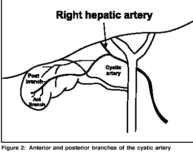 393x317 Jminaccesssurg 2005 1 2 53 165