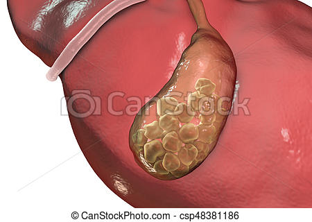 450x320 Gallstones, Illustration Showing Bottom View Of Liver And Stock