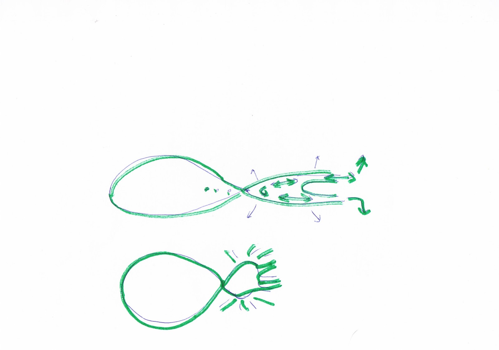 1600x1122 Hourglass Gallbladder