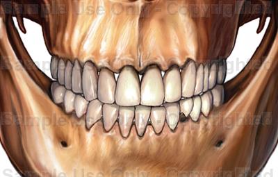 400x255 Collection Of Human Teeth Drawing High Quality, Free