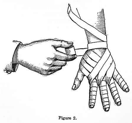 447x418 How Wrap Hand Injury (Mis)adventures