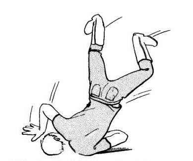 389x325 Brachial Plexus Injury