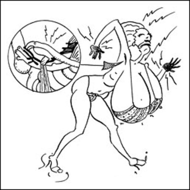 640x640 Can Big Breasts Lead To Injuries