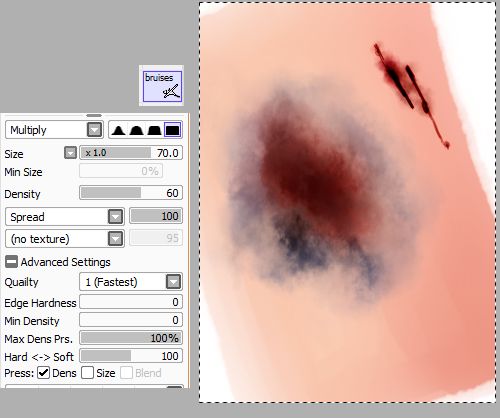 500x418 130 Best Draw Injuries Amp Injured Characters Wounds Bruises