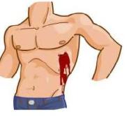 182x166 Apply First Aid