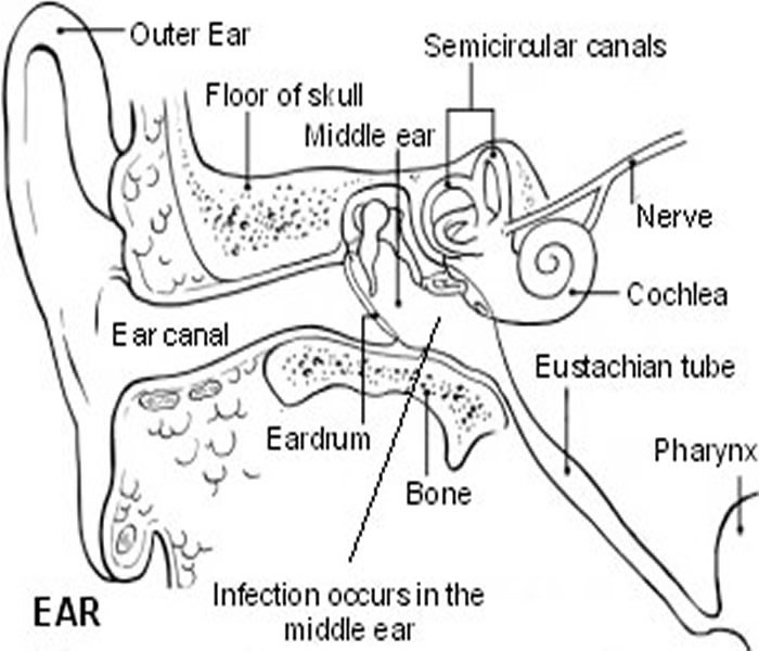 700x600 Ear Infections