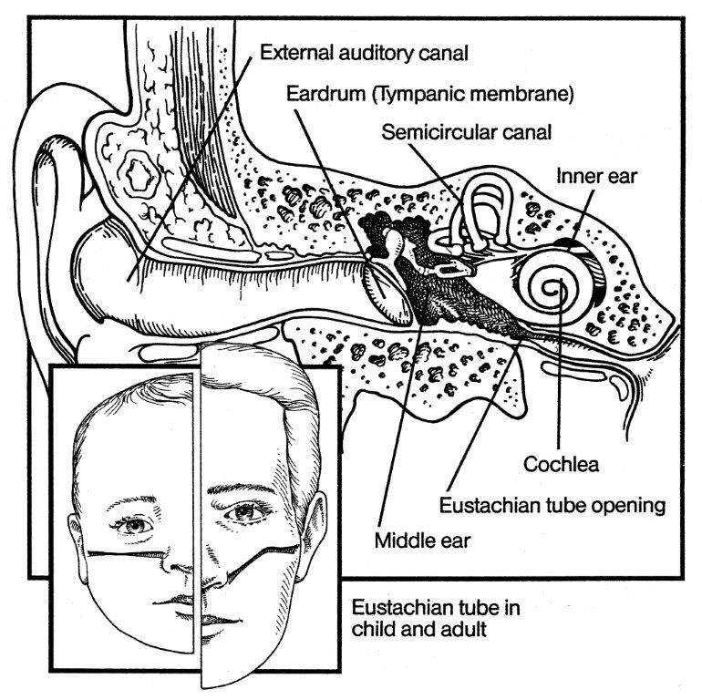 770x768 Ear Infections Why Are They So Common In Kids Salem Pediatric
