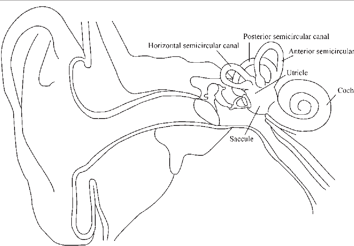 1232x856 Inner Ear Dysfunction Due To Vertebrobasilar Ischemic Stroke