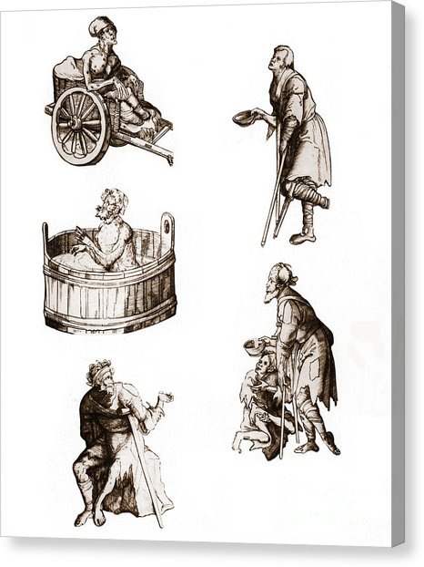 466x622 Leprosy Canvas Prints