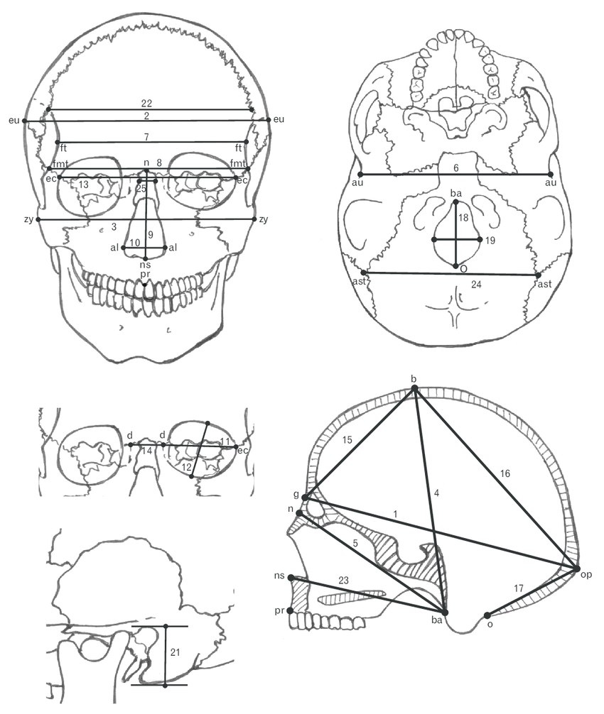 850x1006 Drawing Of Skull Measurements Measured In This Study. Written