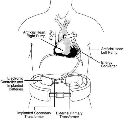 Mechanical Heart Drawing
