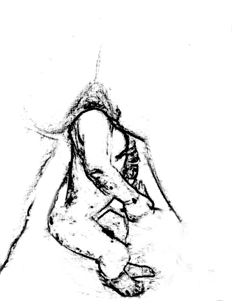 808x1044 Resources And A Plug The Midwife, The Mother And The Breech