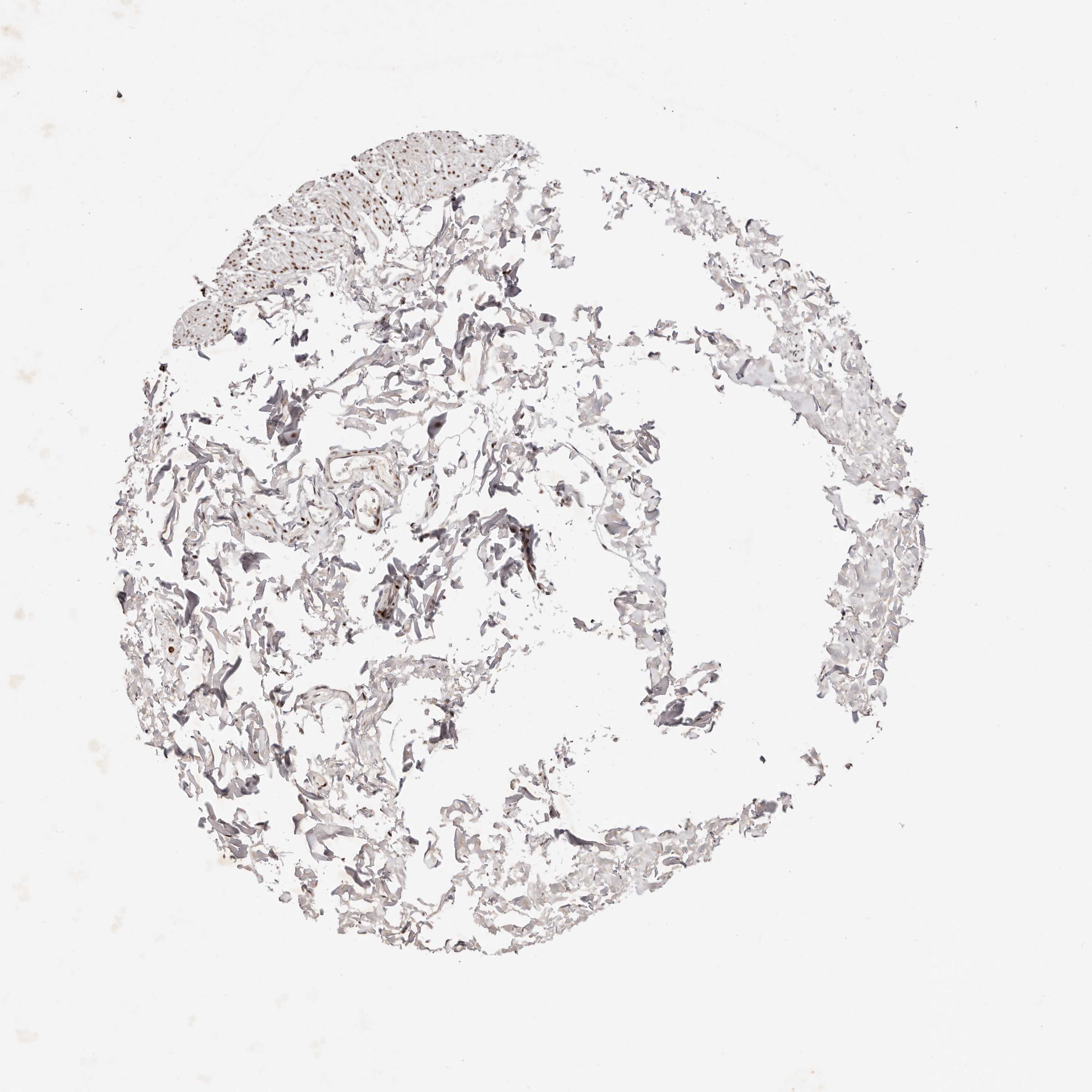 3000x3000 Tissue Expression Of Iqgap3