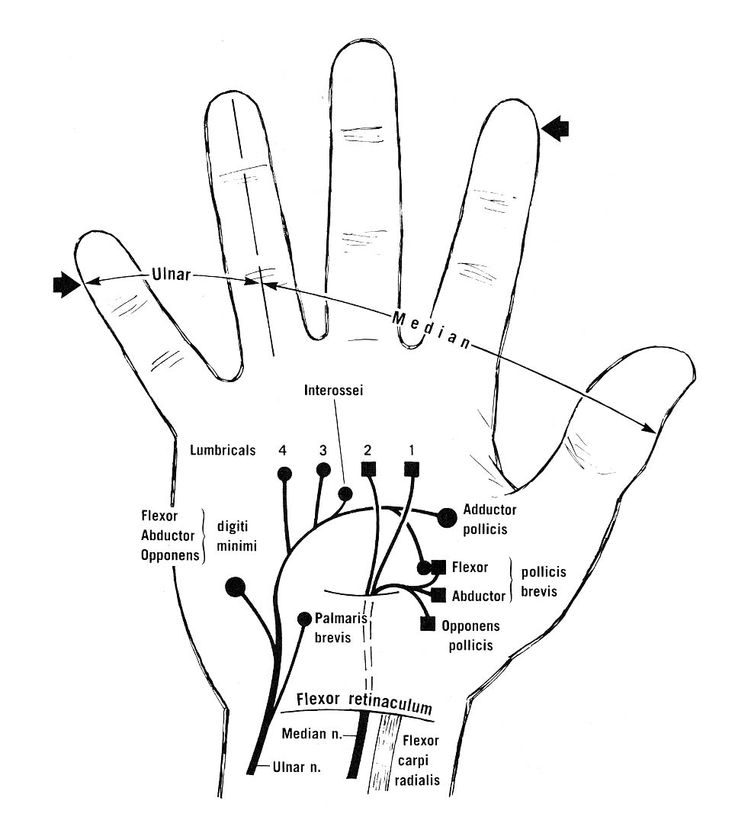 735x833 372 Best Upper Limb Images On Physical Therapy