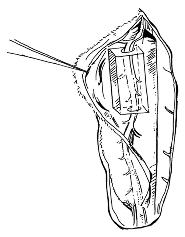600x768 A New Approach Of In Vivo Musculoskeletal Tissue Engineering Using