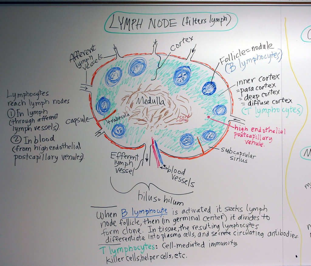 1024x876 Lymphatic System Lymph Node A Hand Drawn Sketch By Dr.