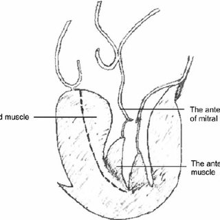 320x320 Drawing Shows Extent Of Resection (Viewed