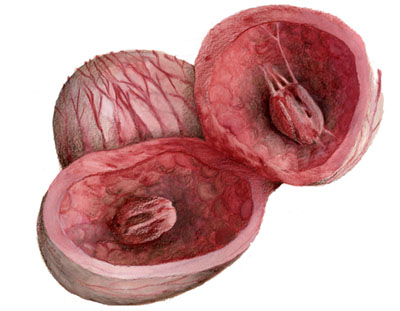 400x311 Imaginary Organs Michelle Day