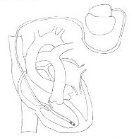 190x195 93242356.jpg