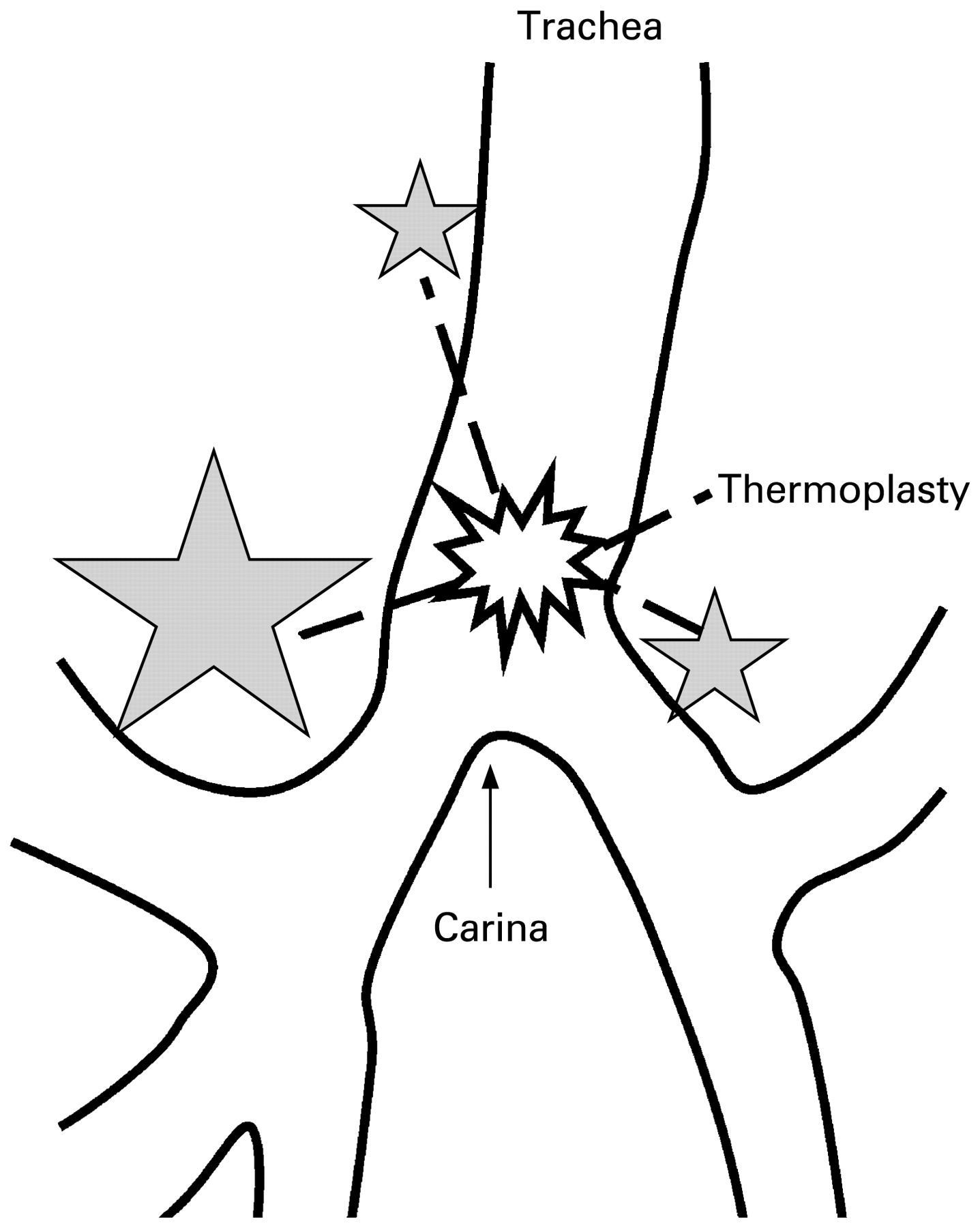 1437x1800 Airway Smooth Muscle An Architect Of The Lung Thorax