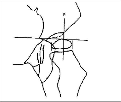 482x406 Migration Percentage Of Reimers. Download Scientific Diagram