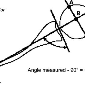 283x283 Schematic Drawing Showing Method For Measuring