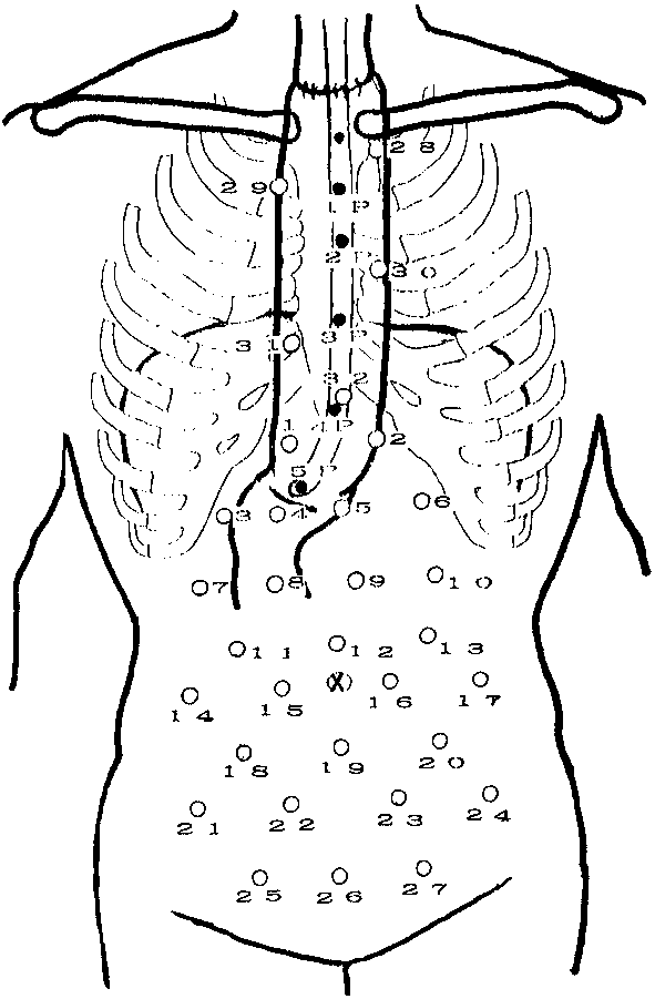 591x901 Schematic Drawing Of The Location Of The Pressure Sensors (Filled