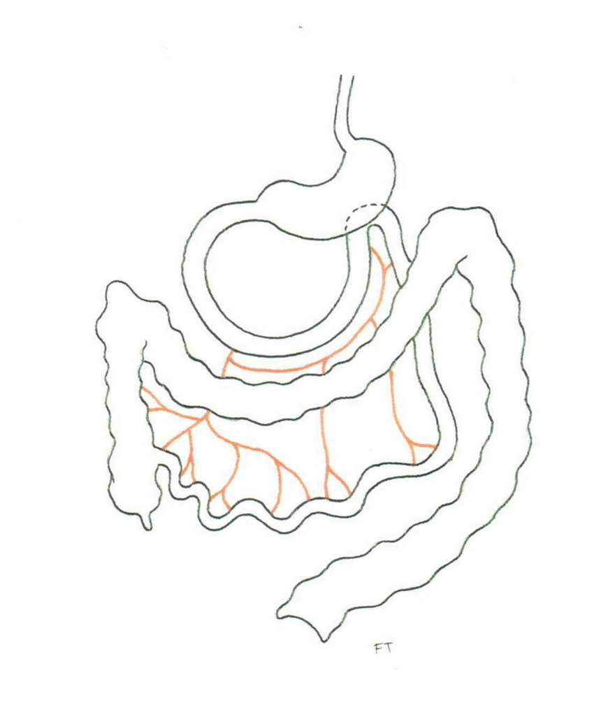 850x1006 Cecum Can Further Develop After Birth, Descending Into The Right