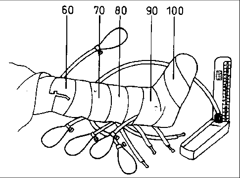 485x359 The Method Using Blood Pressure Apparatus For The Reduction