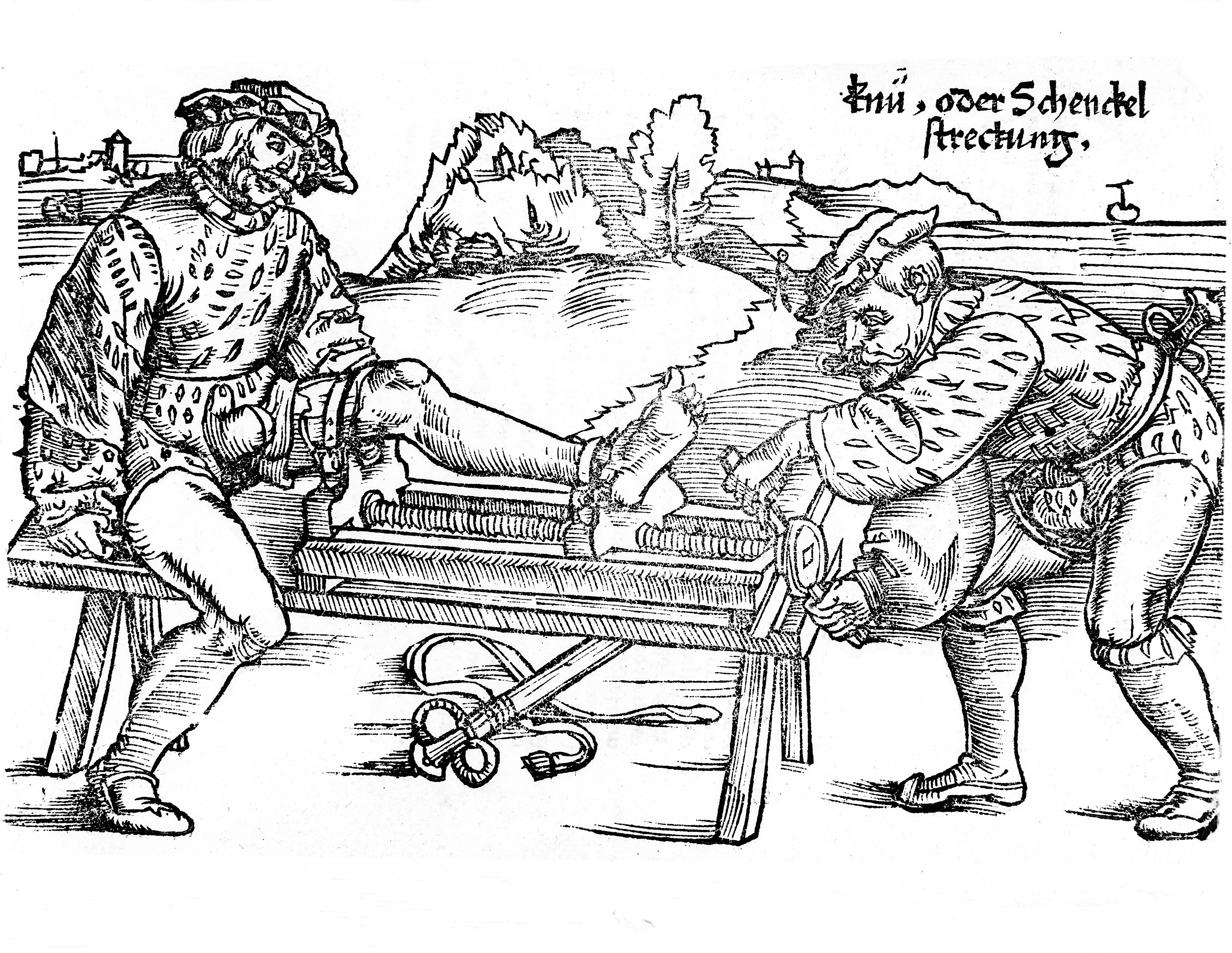 3972x3072 Filereduction Of Of Dislocated Leg, 16th Century Wellcome