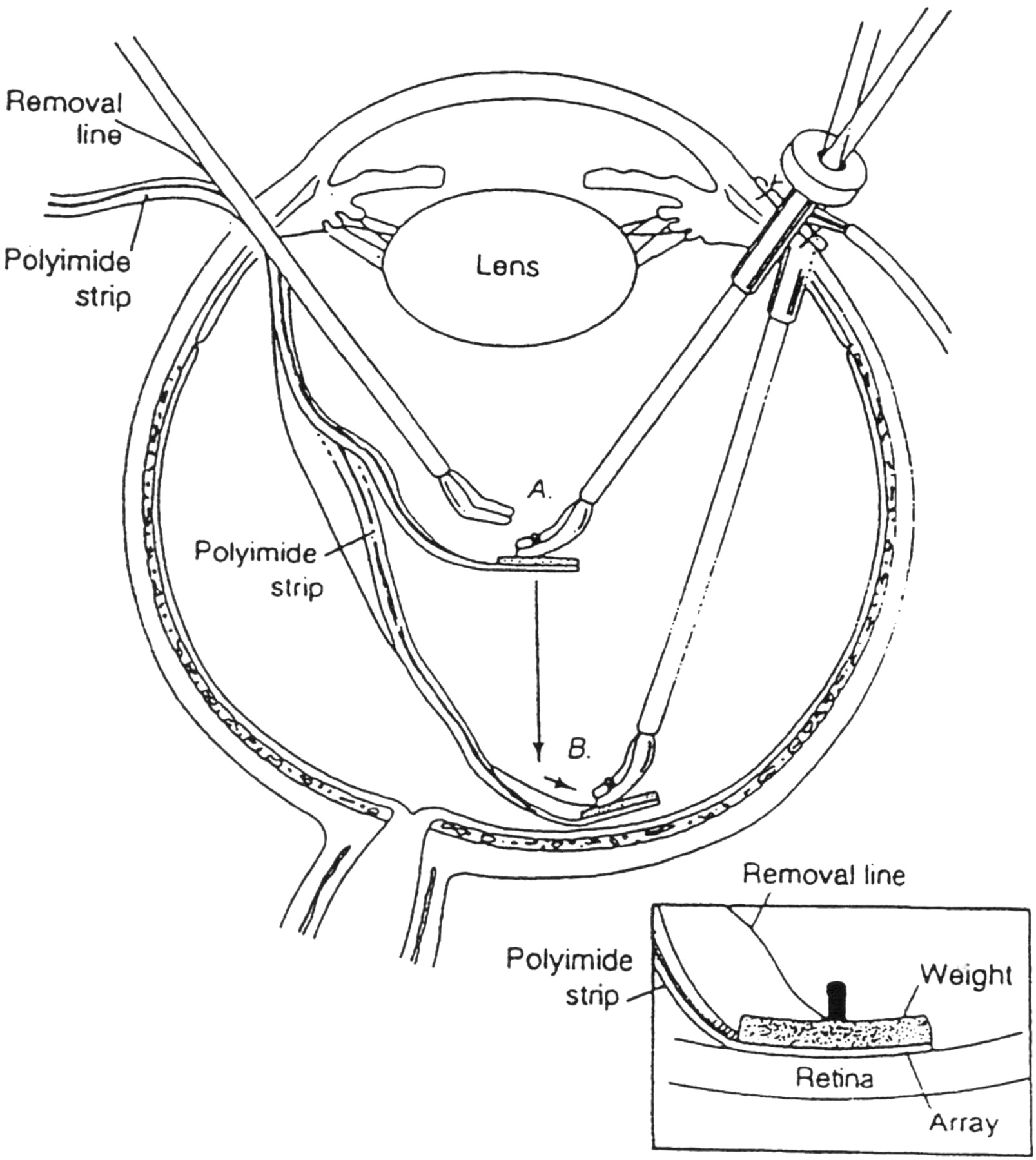 1607x1800 Methods And Perceptual Thresholds For Short Term Electrical