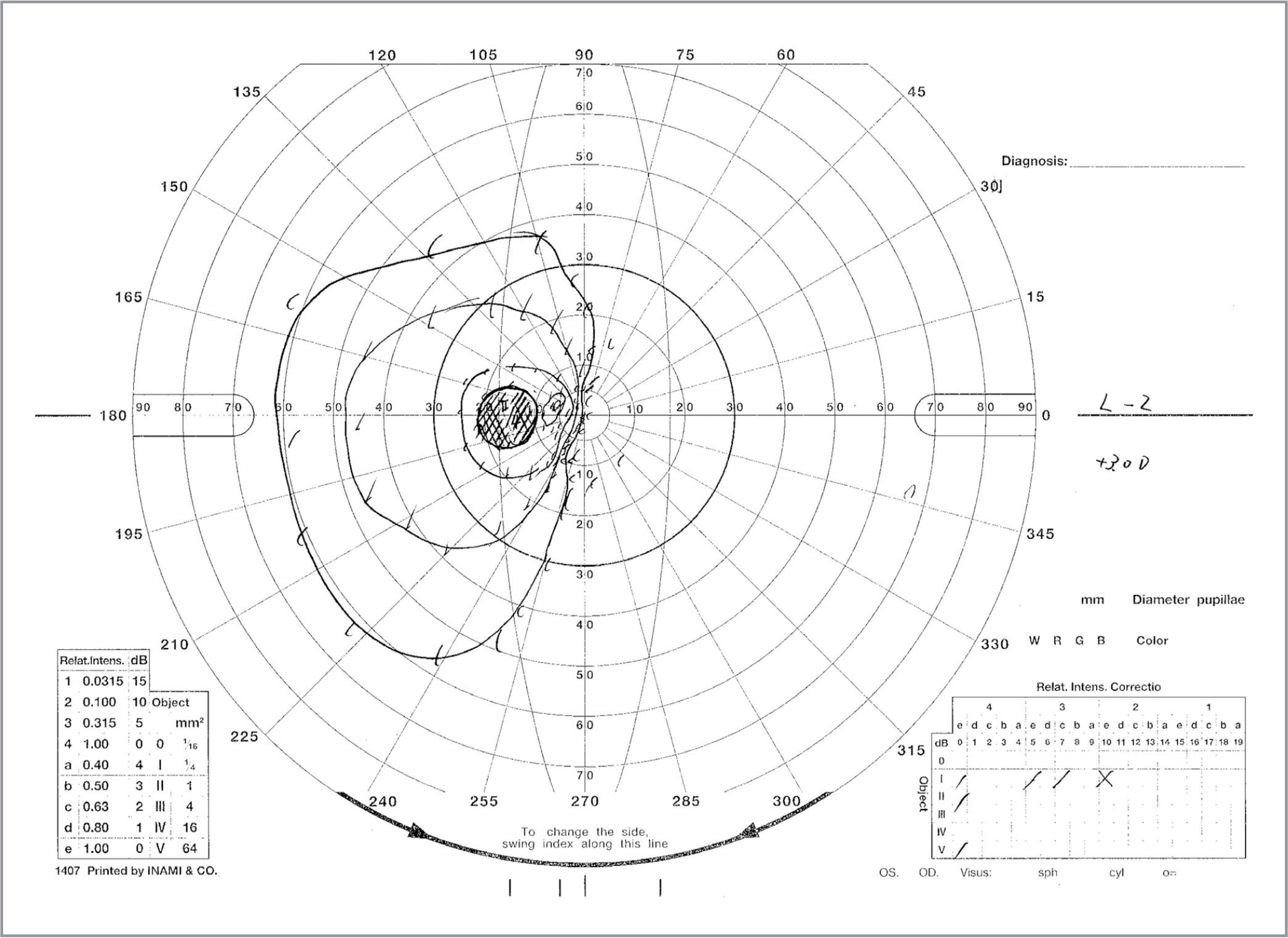 2088x1520 A Case Serious Eye Injury Caused By A Mistaken Injection