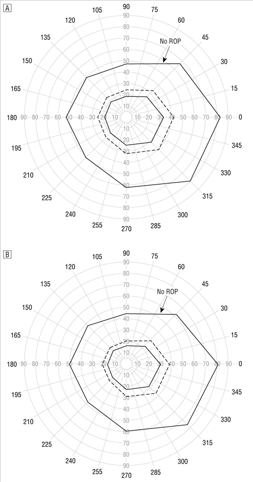 520x992 Effect Retinal Ablative Therapy For Threshold Retinopathy