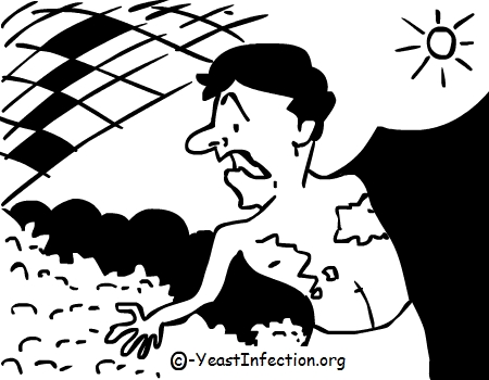 450x350 Tinea Versicolor