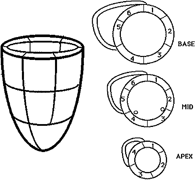 684x631 Illustrative Drawing Of A 16 Segment Left Ventricle (Lv) Model