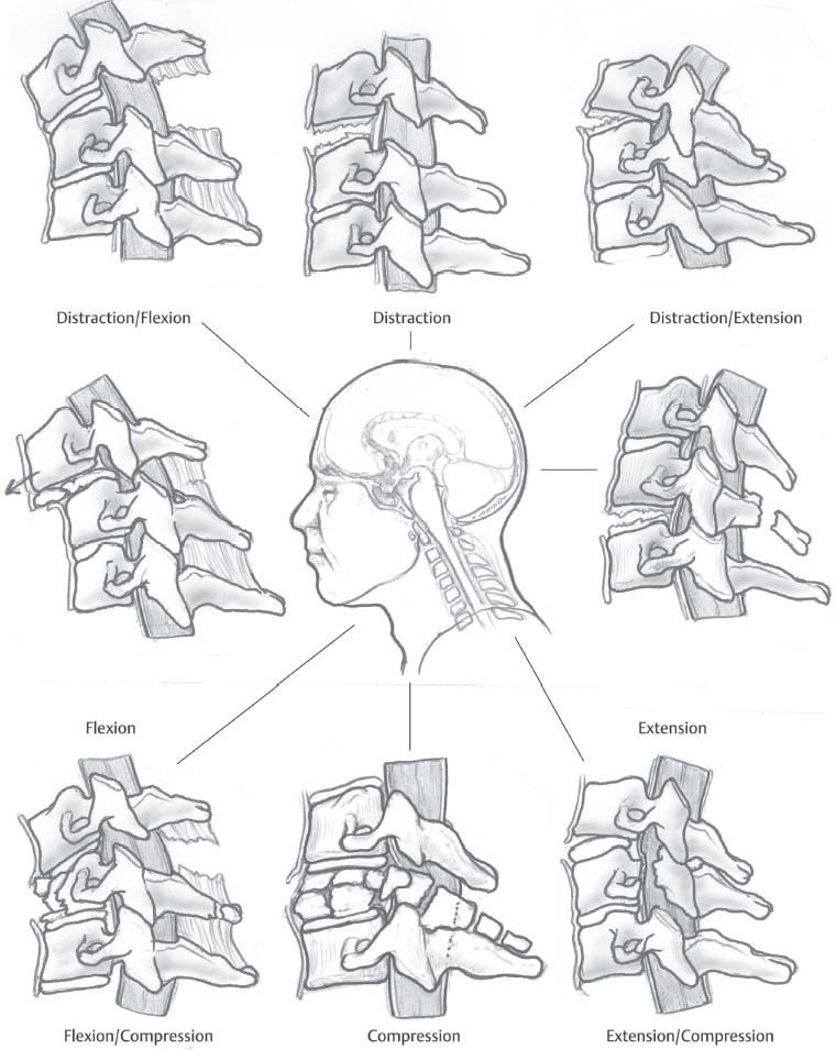 760x955 The Cervical Spine Radiology Key