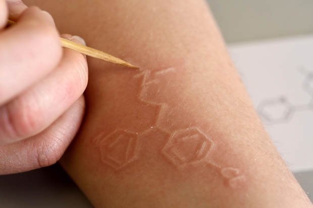 620x413 Dr Zoe Waller Has Rare Medical Condition Daily Star