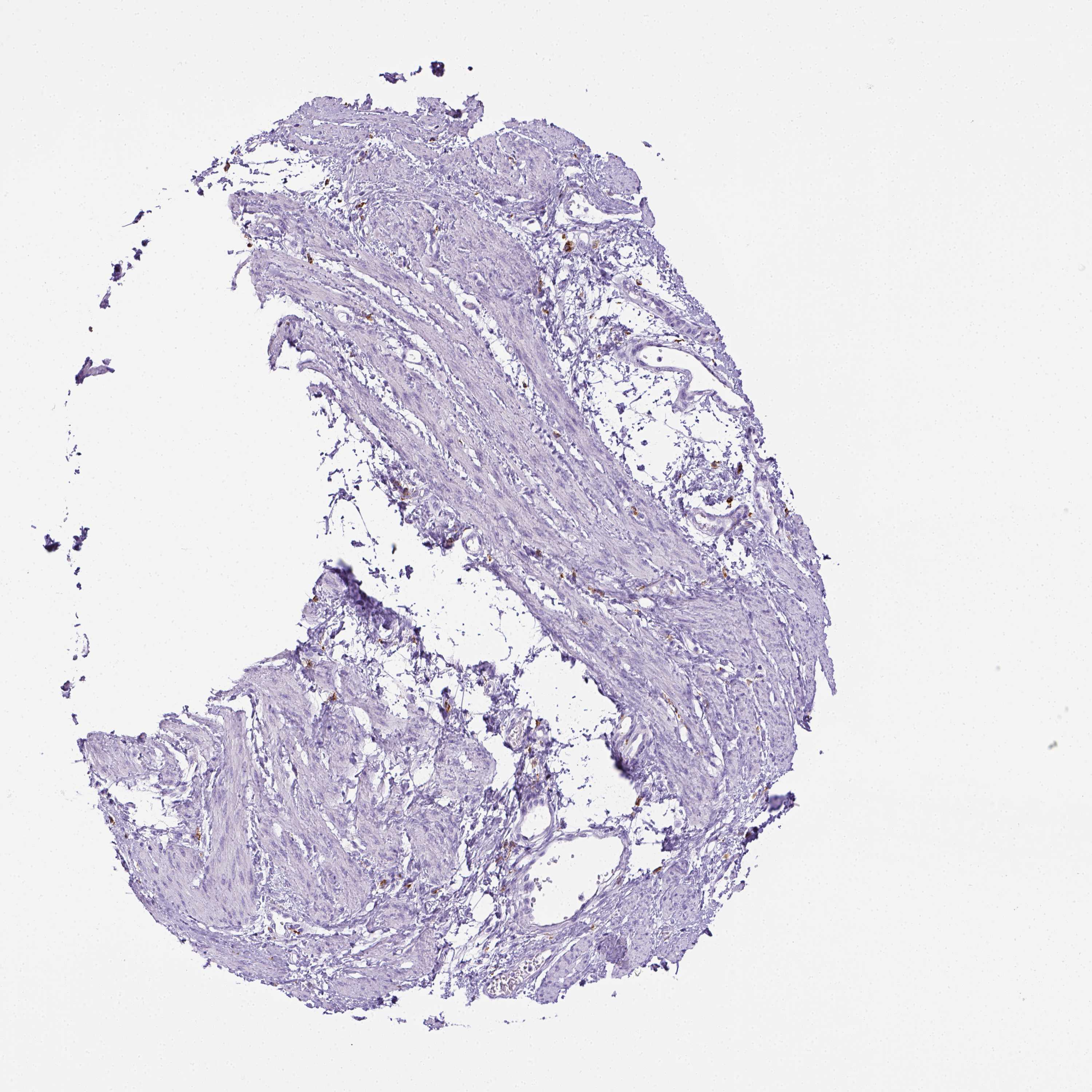 3000x3000 Tissue Expression Of Cd68