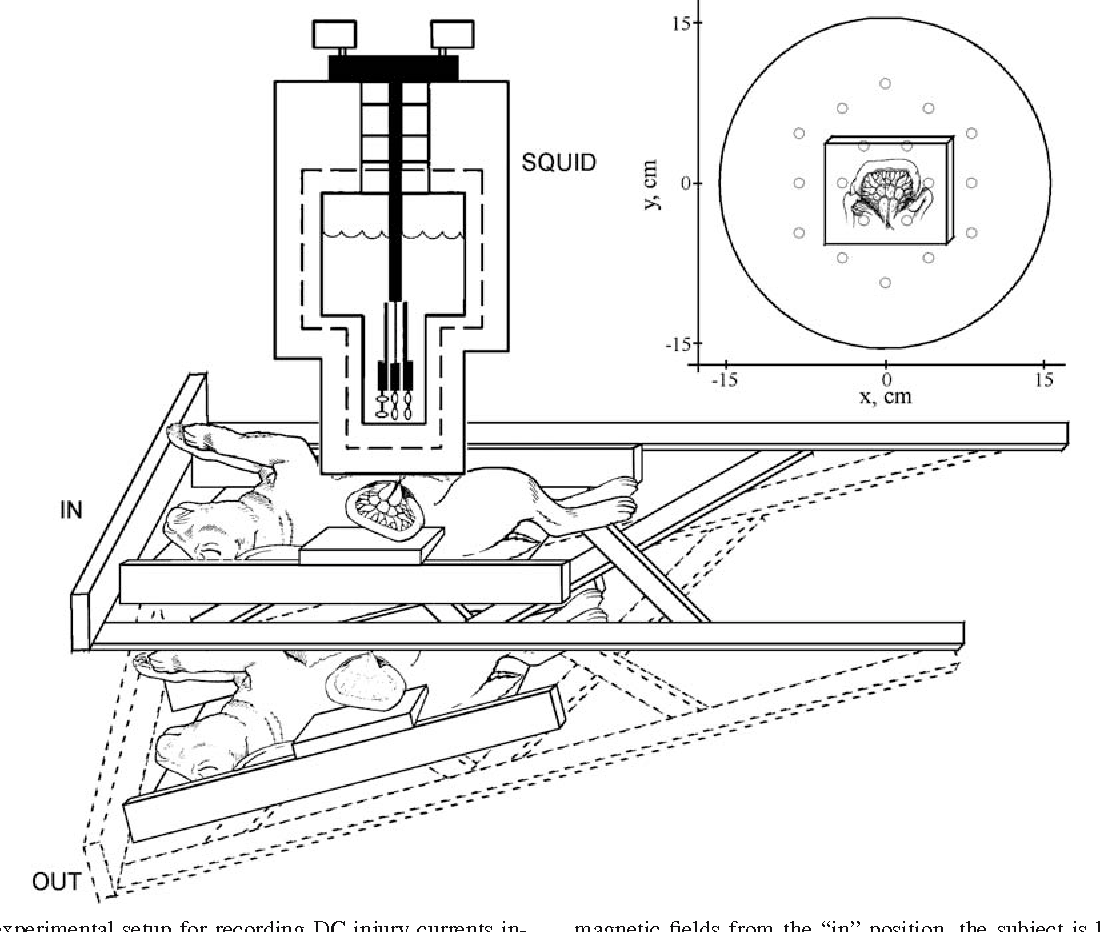 1104x932 Figure 1 From Biomagneticvestigation Ofjury Currents