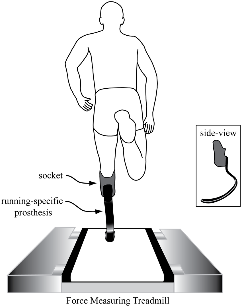 850x1077 A) Rear View Of A Sprinter With A Left Side Transtibial Amputation