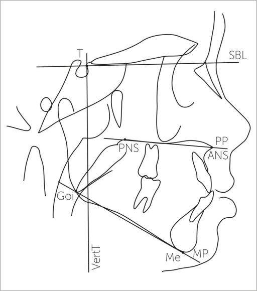 512x580 Basicranial Reference System. Stable Basicranial Line ( Open I