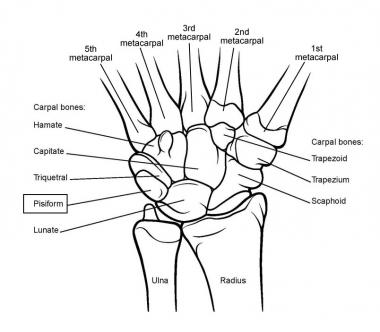 380x332 Arthritis Of The Wrist And Hand Glenelg Orthopaedics