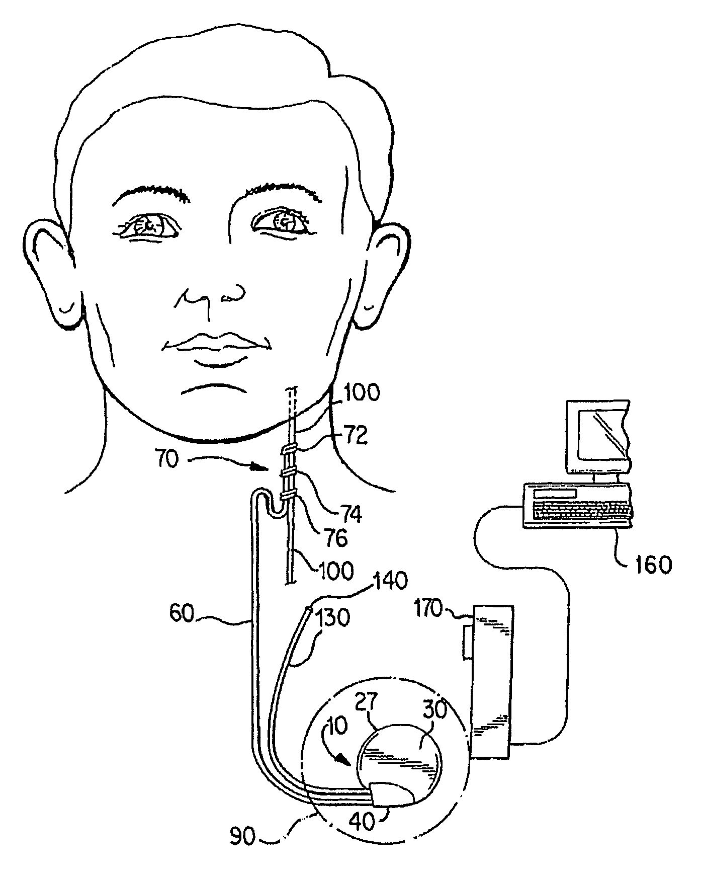 1394x1745 Cranial Nerve Face Drawing Patent Us8700163